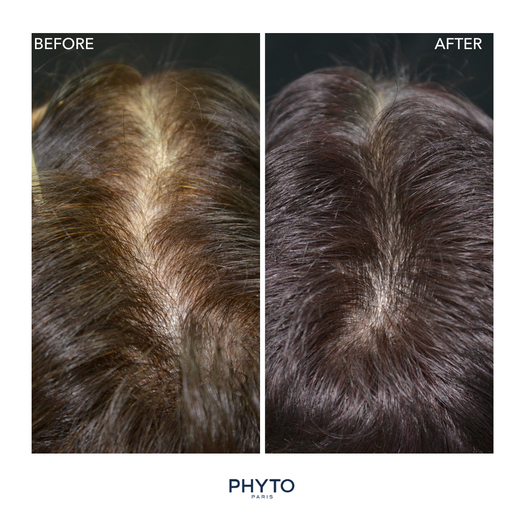 PHYTOCYANE Anti-Hair Thinning Dietary Supplement (12-Week Supply)