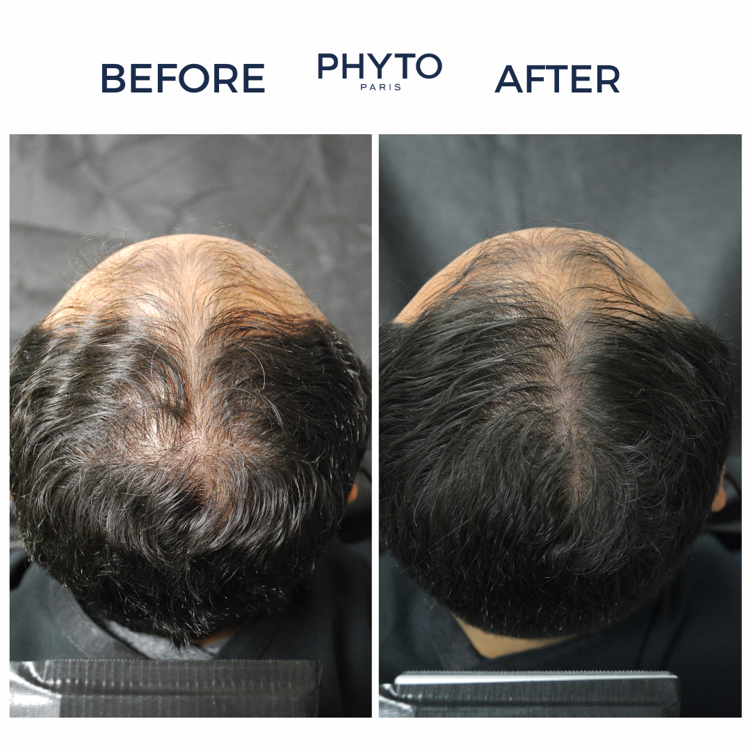 PHYTOCYANE Densifying Treatment for Progressive Hair Thinning - Men
